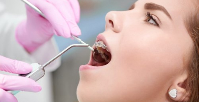 La ortodoncia en adultos