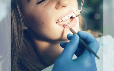 La adolescencia es el momento ideal para la ortodoncia