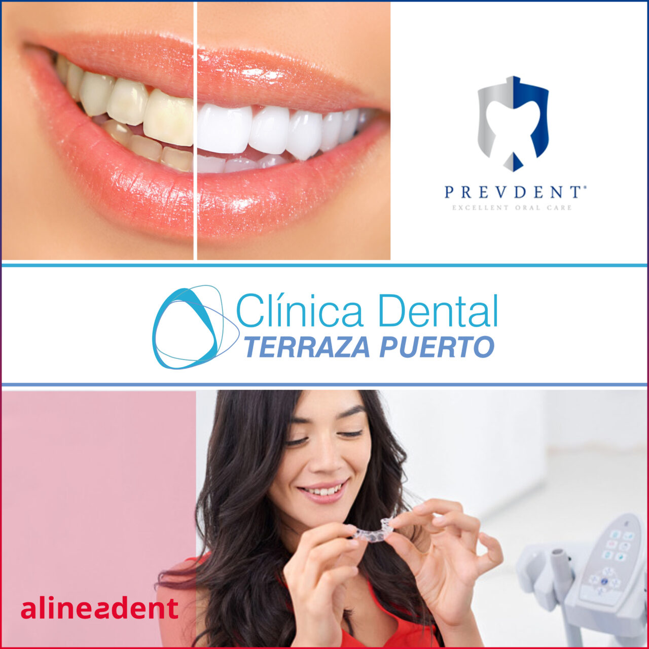 Cuidados Para Después Del Blanqueamiento Dental. - Clinica Dental Terraza