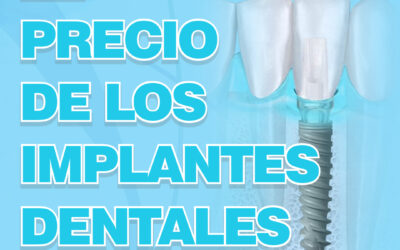 El precio de los implantes dentales.